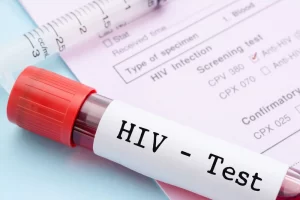 Tội lây truyền HIV cho người khác theo Bộ luật hình sự năm 2015 bị đi tù bao lâu? (Hình từ Internet)