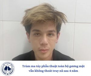rùm ma túy phẫu thuật toàn bộ gương mặt vẫn không thoát truy nã sau 4 năm